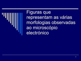 Figuras que representam as várias morfologias observadas ao microscópio electrónico  