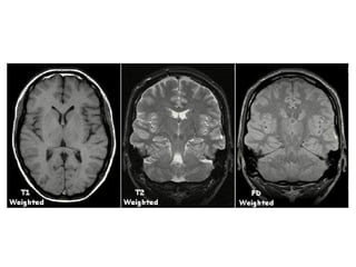 Comprehensive Overview of MRI Technology and Imaging Principles | PPTX