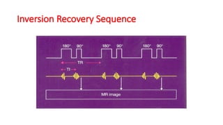 Inversion Recovery Sequence
 