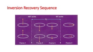 Inversion Recovery Sequence
 