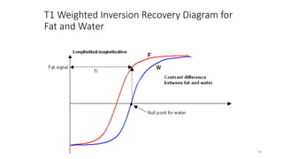 T1 Weighted Inversion Recovery Diagram for
Fat and Water
34
 