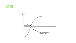 STIR
 