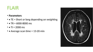 FLAIR
• Parameters
• • TE = Short or long depending on weighting
• • TR = 6000-8000 ms
• • TI = 2000 ms
• • Average scan time = 13-20 min
 