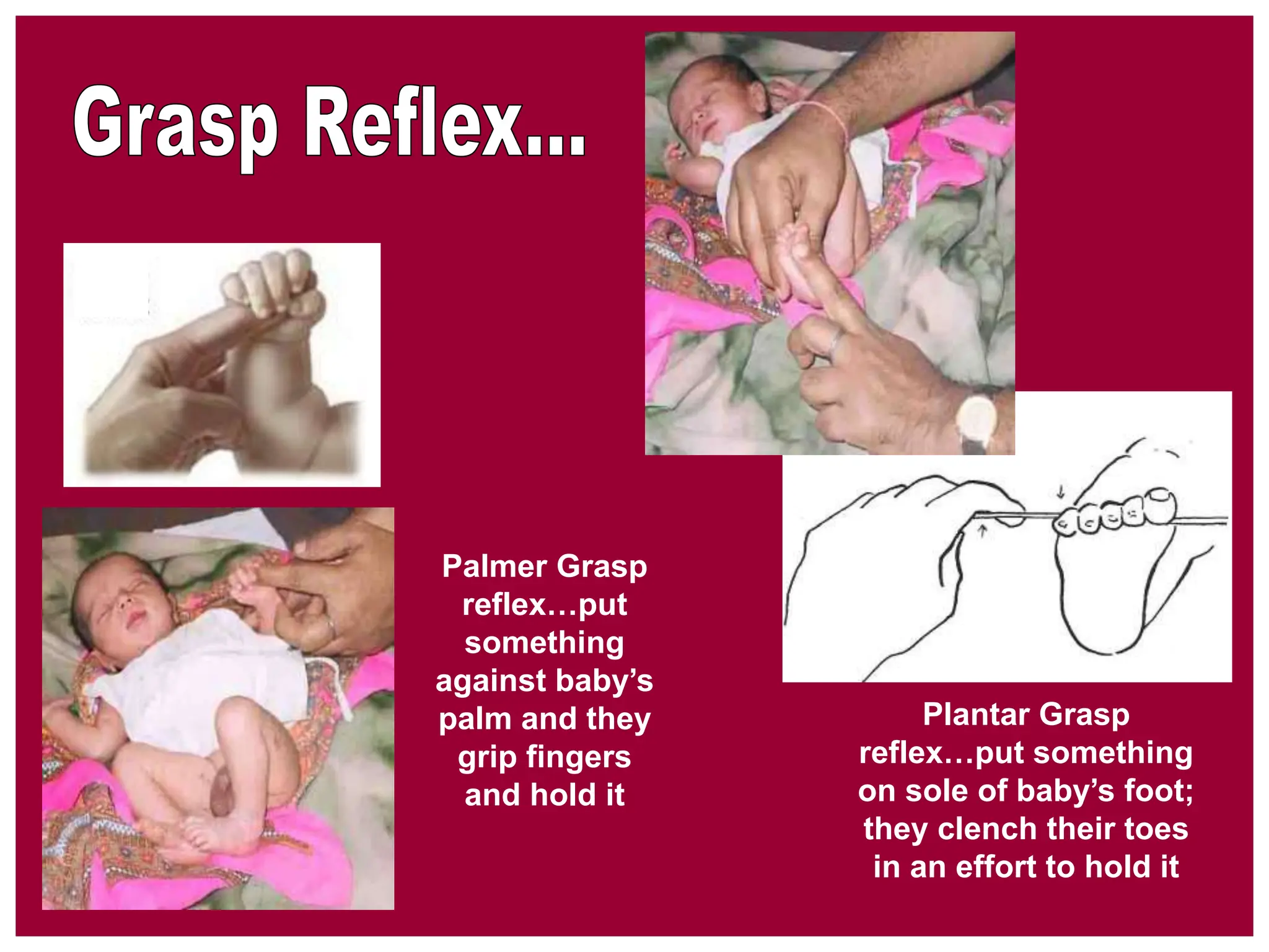 Neonatal-Evaluation-and-management ..ppt