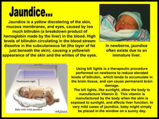 Neonatal-Evaluation-and-management ..ppt