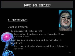 DRUGS FOR SEIZURES




2. SUCCINIMIDES

ADVERSE EFFECTS:
• Depressing effects in CNS:
  – Depression, drowsiness, ataxia, insomnia, HA and
    blurred vision
• Bone marrow suppression and dermatologic
  reaction:
  – Pruritus, urticaria, alopecia and Steven Johnson’s
    syndrome
                                                         28
 