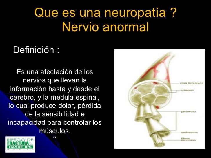 4.otras causas de dolor neuropatico 4.otras causas de dolor neuropatico