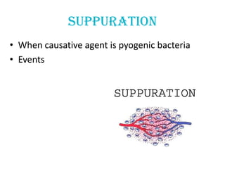 suppuration
• When causative agent is pyogenic bacteria
• Events
 