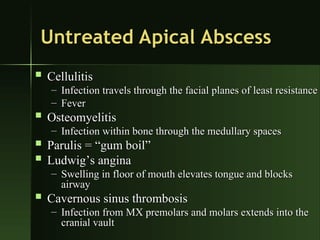 Abscess Block oral pathology 4-Periapical Pathology 4.ppt