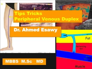 Dr Ahmed Esawy
Tips Tricks
Peripheral Venous Duplex
Dr. Ahmed Esawy
MBBS M.Sc MD
 