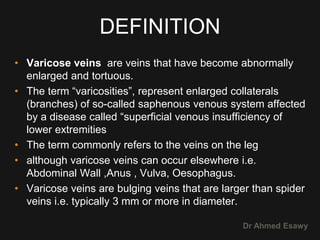 4 peripheral venous duplex pt 4 varices dr ahmed esawy | PPT