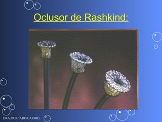Conservative Rashkind Bas 4 Persistencia Del Conducto Arterioso | PPT