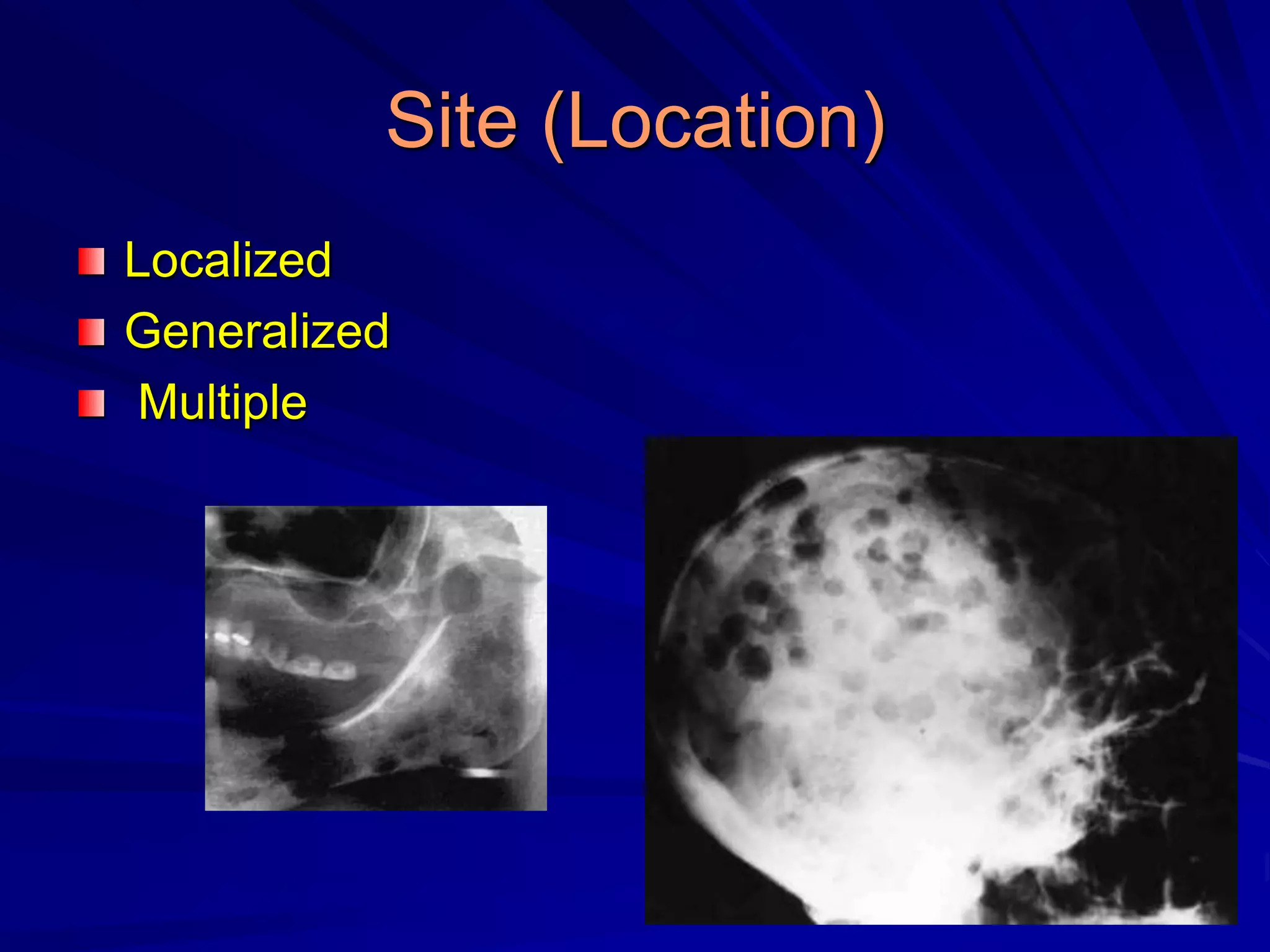 Site (Location)
Localized
Generalized
Multiple
 
