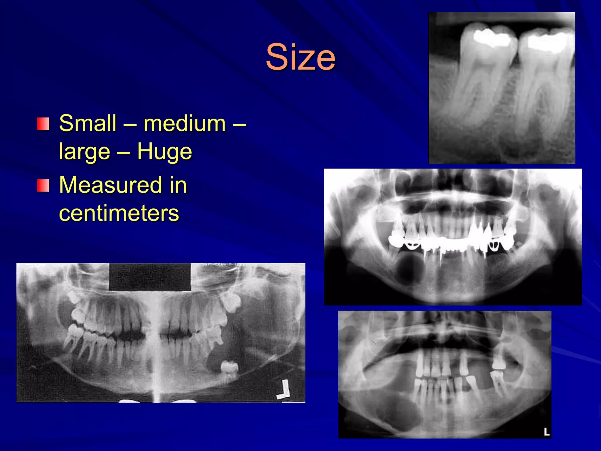 Size
Small – medium –
large – Huge
Measured in
centimeters
 