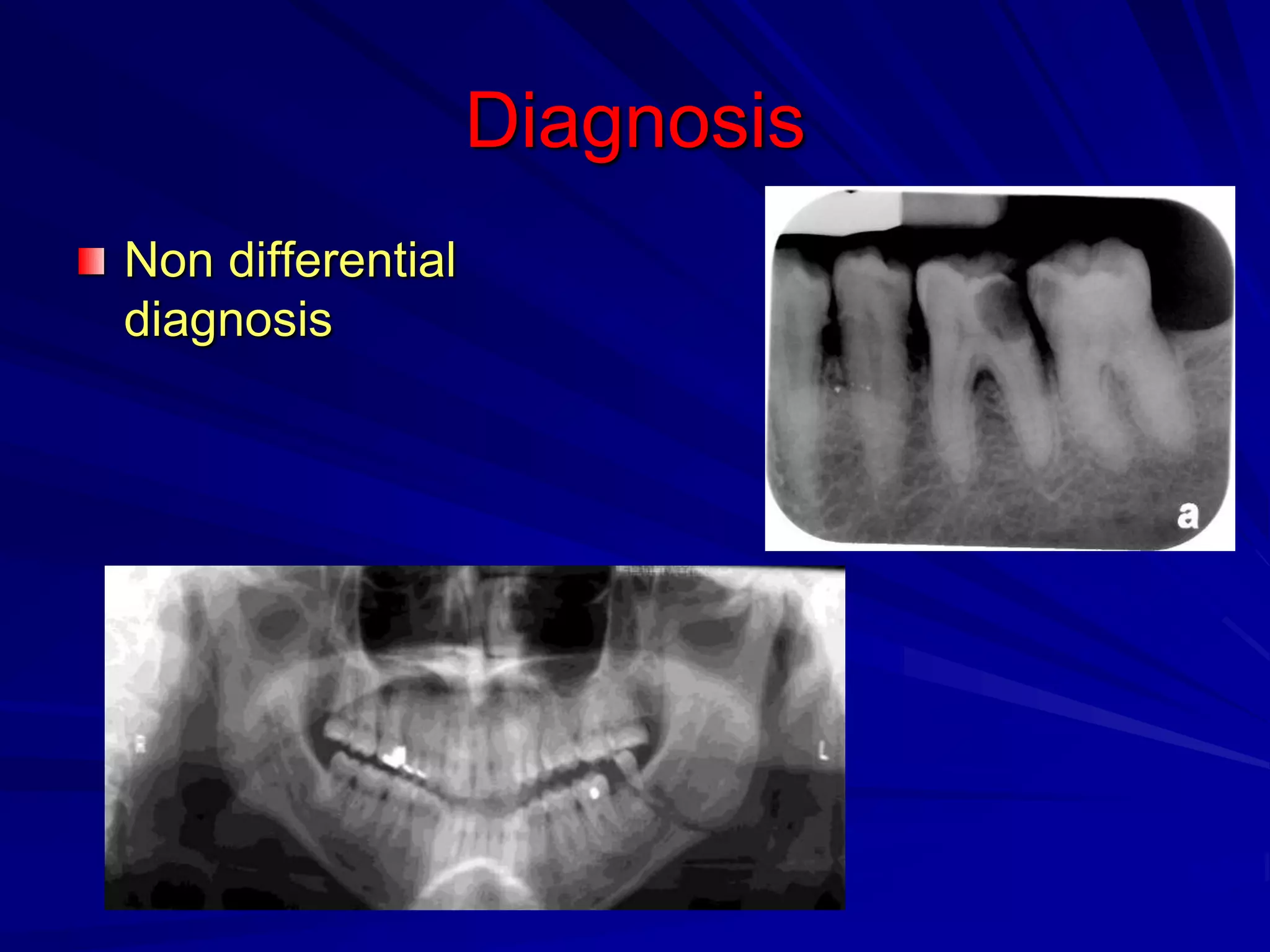 Diagnosis
Non differential
diagnosis
 