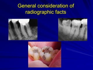 General consideration of
radiographic facts
 