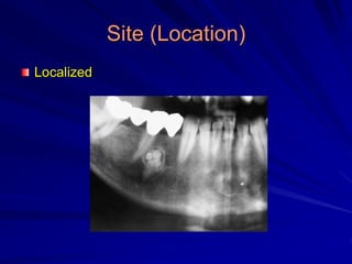 Site (Location)
Localized
 