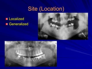 Site (Location)
Localized
Generalized
 
