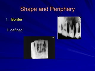 Shape and Periphery
1. Border
Ill defined
 