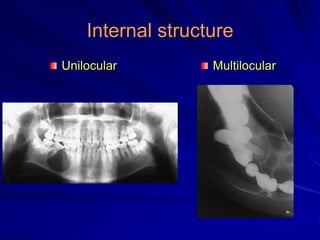 Internal structure
Unilocular Multilocular
 