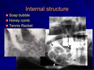 Internal structure
Soap bubble
Honey comb
Tennis Racket
 