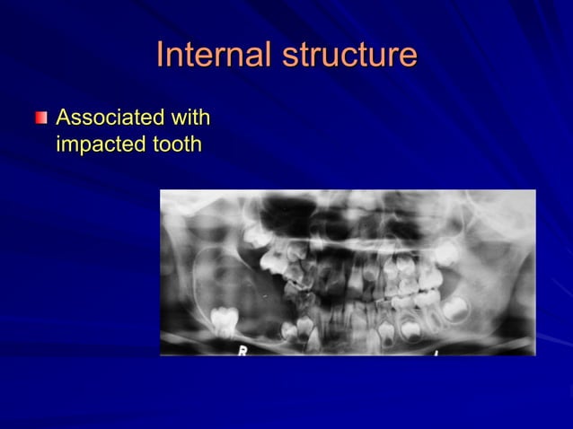Principles Of Radiographic Interpretation | PPSX | Dental Health ...