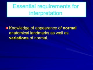 Knowledge of appearance of normal
anatomical landmarks as well as
variations of normal.
Essential requirements for
interpretation
 