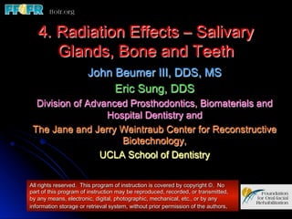 4. Radiation Effects – Salivary
      Glands, Bone and Teeth
                       John Beumer III, DDS, MS
                            Eric Sung, DDS
  Division of Advanced Prosthodontics, Biomaterials and
                  Hospital Dentistry and
 The Jane and Jerry Weintraub Center for Reconstructive
                     Biotechnology,
                 UCLA School of Dentistry


All rights reserved. This program of instruction is covered by copyright ©. No
part of this program of instruction may be reproduced, recorded, or transmitted,
by any means, electronic, digital, photographic, mechanical, etc., or by any
information storage or retrieval system, without prior permission of the authors.
 