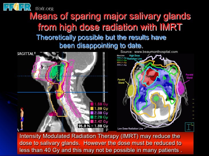 4.radiation effects salivary glands, bone and teeth