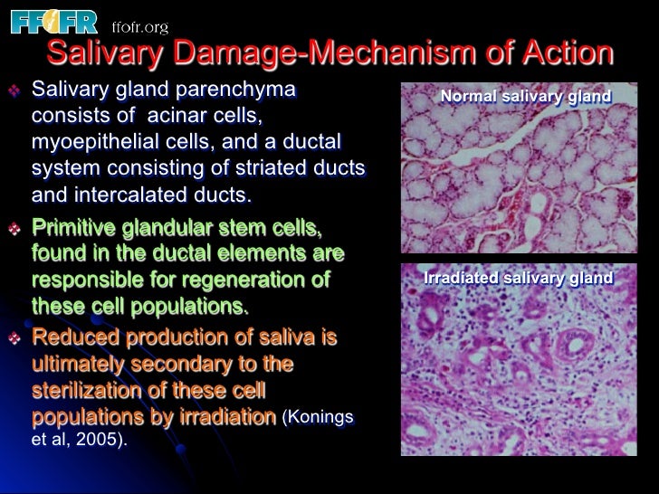 4.radiation effects salivary glands, bone and teeth
