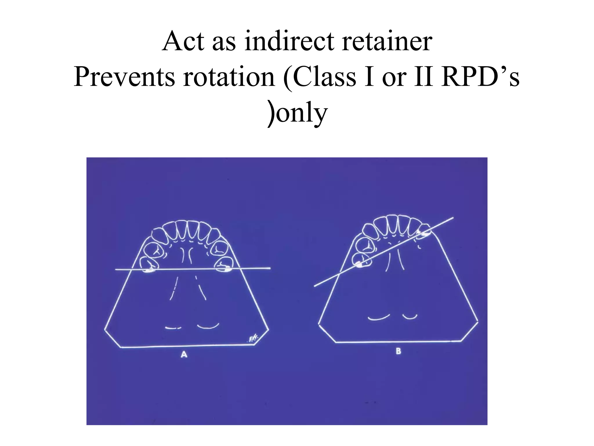 4 rests and rest seats | PPT