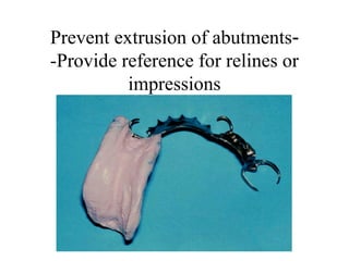 -Prevent extrusion of abutments
-Provide reference for relines or
impressions
 