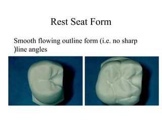 Rest Seat Form
Smooth flowing outline form (i.e. no sharp
line angles(
 