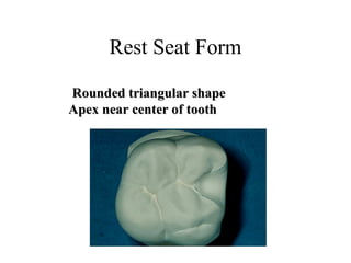 Rest Seat Form
Rounded triangular shapeRounded triangular shape
Apex near center of toothApex near center of tooth
 