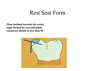 Rest Seat Form
Floor inclined towards the centerFloor inclined towards the center
Angle formed by rest and minorAngle formed by rest and minor
connector should be less than 90connector should be less than 90◦◦
 