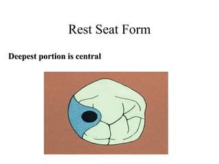 Rest Seat Form
Deepest portion is centralDeepest portion is central
 