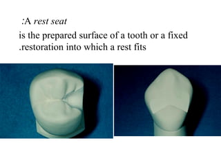 A rest seat:
is the prepared surface of a tooth or a fixed
restoration into which a rest fits.
 