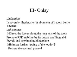 III- Onlay
Indication:
In severely tilted posterior abutment of a tooth borne
segment.
Advantages:
l-Direct the forces along the long axis of the tooth.
2-Promote RPD stability by its buccal and lingual
bevels and proximal guiding plane.
3-Minimize further tipping of the tooth.
4-Restore the occlusal plane.
 