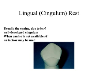 Lingual (Cingulum) Rest
11--Usually the canine, due to itsUsually the canine, due to its
well-developed cingulumwell-developed cingulum
22--When canine is not available,When canine is not available,
an incisor may be usedan incisor may be used
 