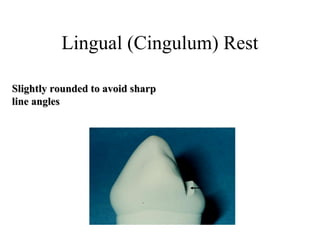 Lingual (Cingulum) Rest
Slightly rounded to avoid sharpSlightly rounded to avoid sharp
line anglesline angles
 