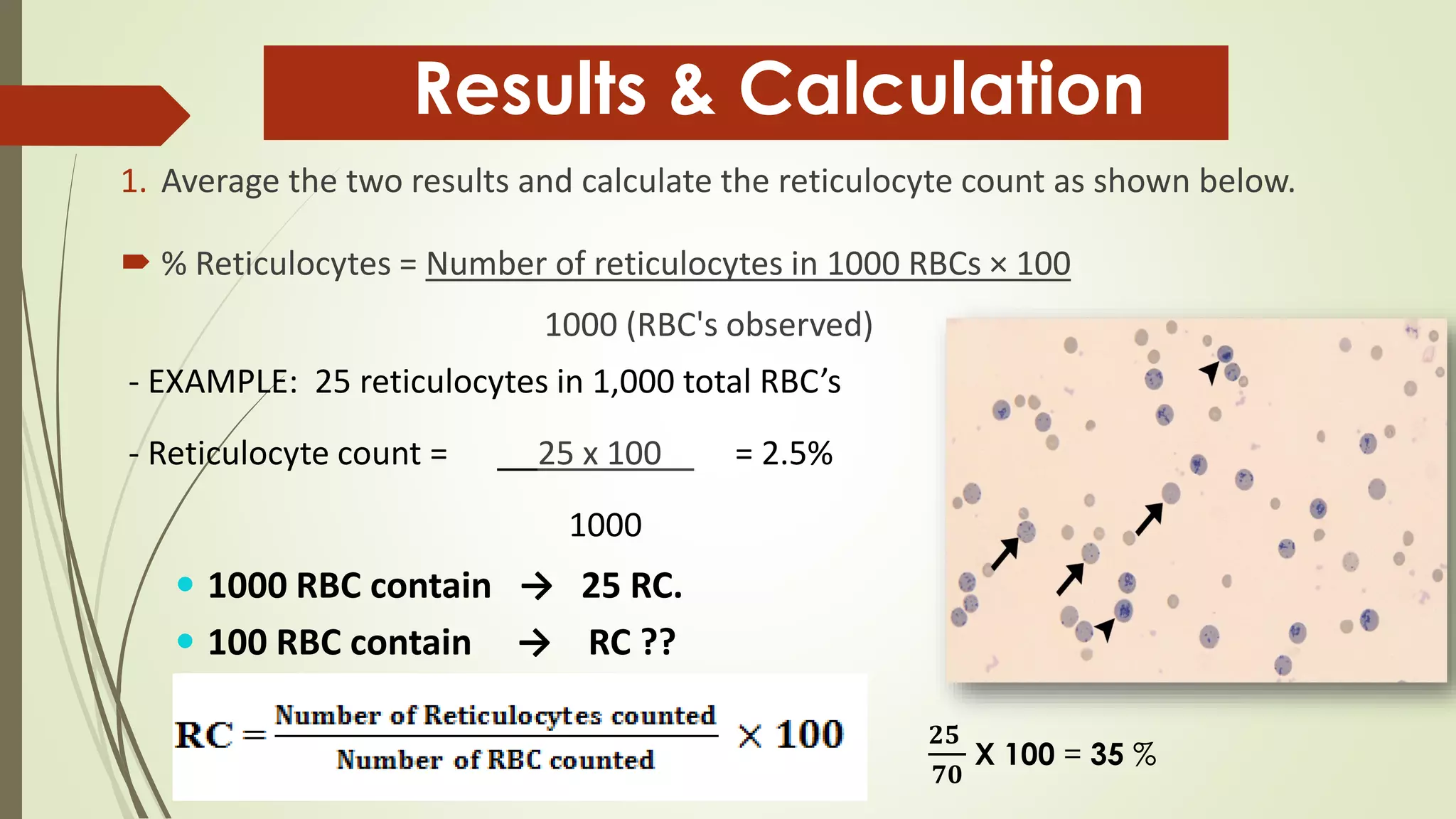 1. Average the two results and calculate the reticulocyte count as shown below.
 % Reticulocytes = Number of reticulocytes in 1000 RBCs × 100
1000 (RBC's observed)
- EXAMPLE: 25 reticulocytes in 1,000 total RBC’s
- Reticulocyte count = 25 x 100 = 2.5%
1000
 1000 RBC contain → 25 RC.
 100 RBC contain → RC ??
Results & Calculation
𝟐𝟓
𝟕𝟎
X 100 = 35 %
 