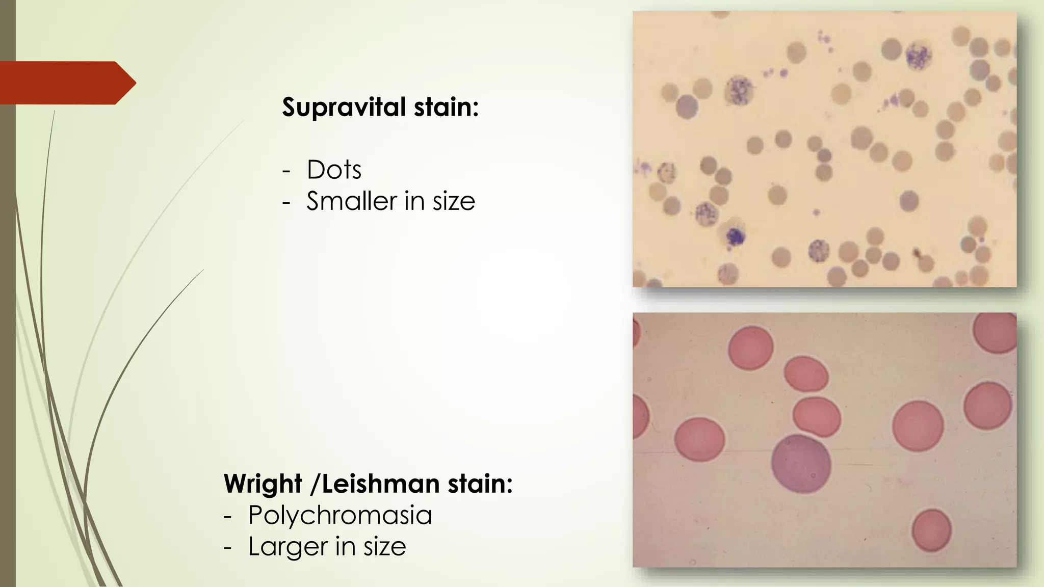 Wright /Leishman stain:
- Polychromasia
- Larger in size
Supravital stain:
- Dots
- Smaller in size
 