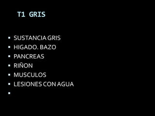 T1 GRIS

 SUSTANCIA GRIS
 HIGADO. BAZO
 PANCREAS
 RIÑON
 MUSCULOS
 LESIONES CON AGUA

 
