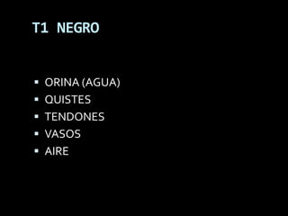 T1 NEGRO


 ORINA (AGUA)
 QUISTES
 TENDONES
 VASOS
 AIRE
 
