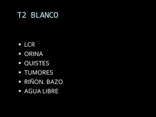 T2 BLANCO


 LCR
 ORINA
 QUISTES
 TUMORES
 RIÑON. BAZO
 AGUA LIBRE
 