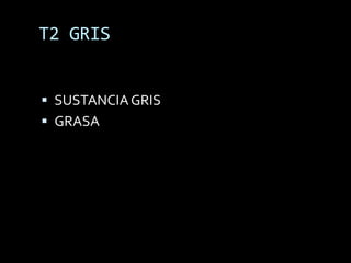 T2 GRIS


 SUSTANCIA GRIS
 GRASA
 