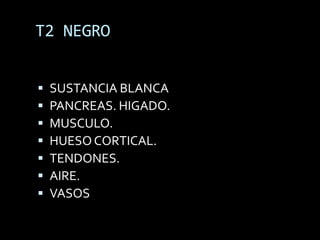 T2 NEGRO


   SUSTANCIA BLANCA
   PANCREAS. HIGADO.
   MUSCULO.
   HUESO CORTICAL.
   TENDONES.
   AIRE.
   VASOS
 
