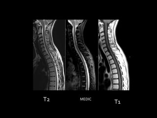 T2   MEDIC
             T1
 