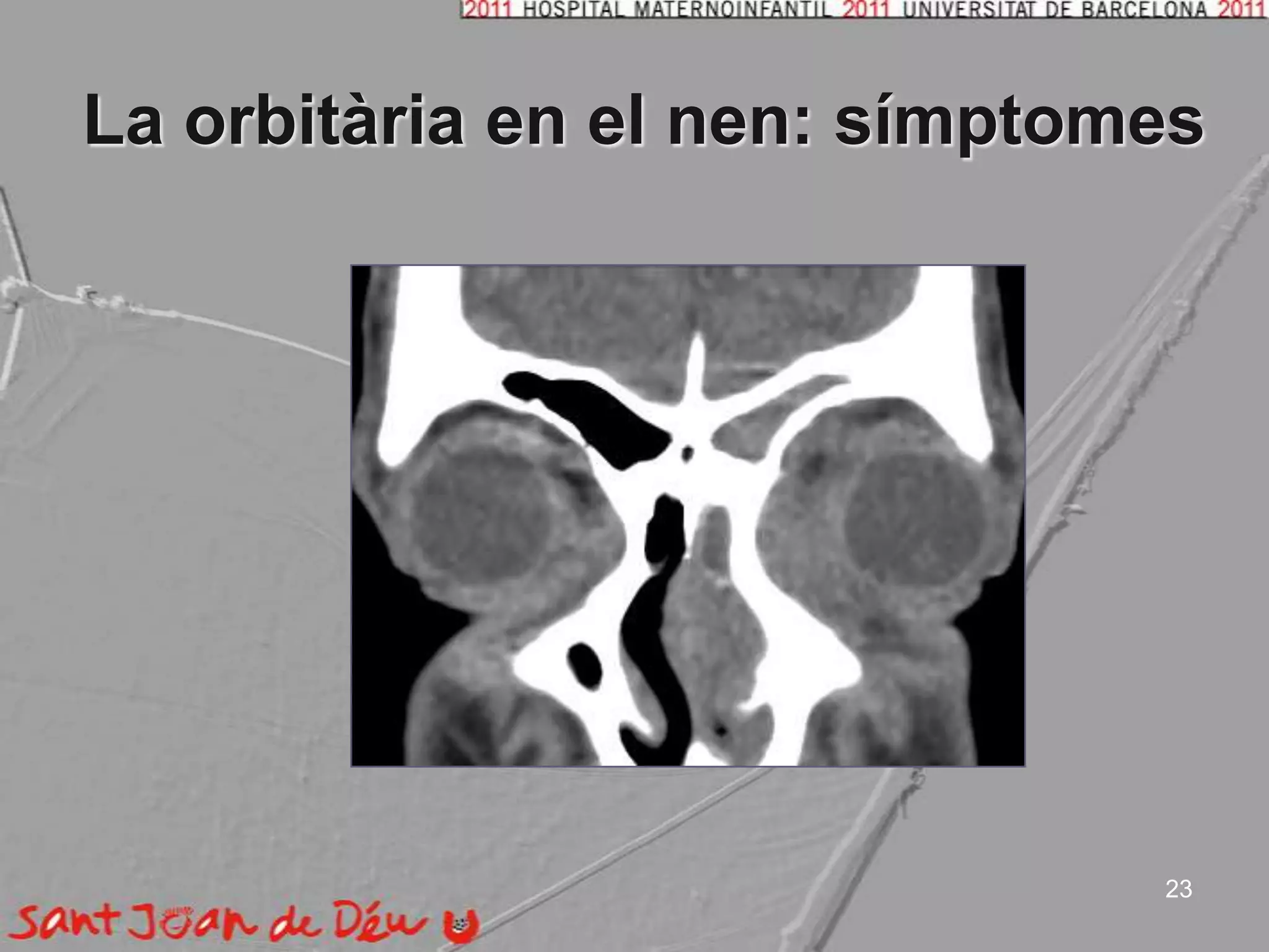 La orbitària en el nen: símptomes23
