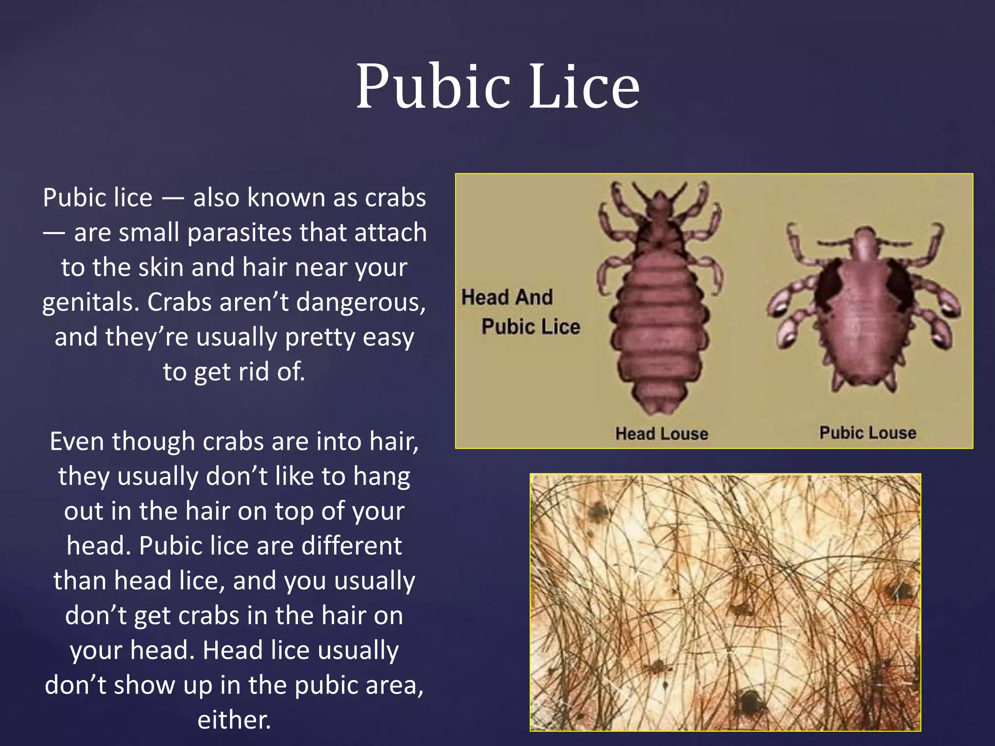 Pubic Lice
Pubic lice — also known as crabs
— are small parasites that attach
to the skin and hair near your
genitals. Crabs aren’t dangerous,
and they’re usually pretty easy
to get rid of.
Even though crabs are into hair,
they usually don’t like to hang
out in the hair on top of your
head. Pubic lice are different
than head lice, and you usually
don’t get crabs in the hair on
your head. Head lice usually
don’t show up in the pubic area,
either.
 